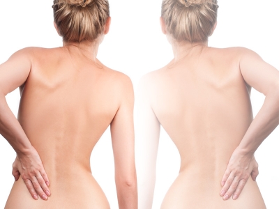 La fibromialgia y Cellfood